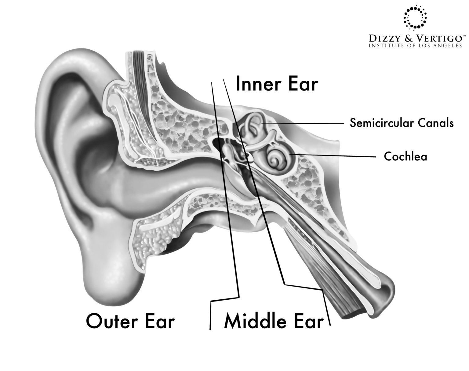 Labyrinthitis Basics What is Labyrinthitis Dizzy & Vertigo Institute